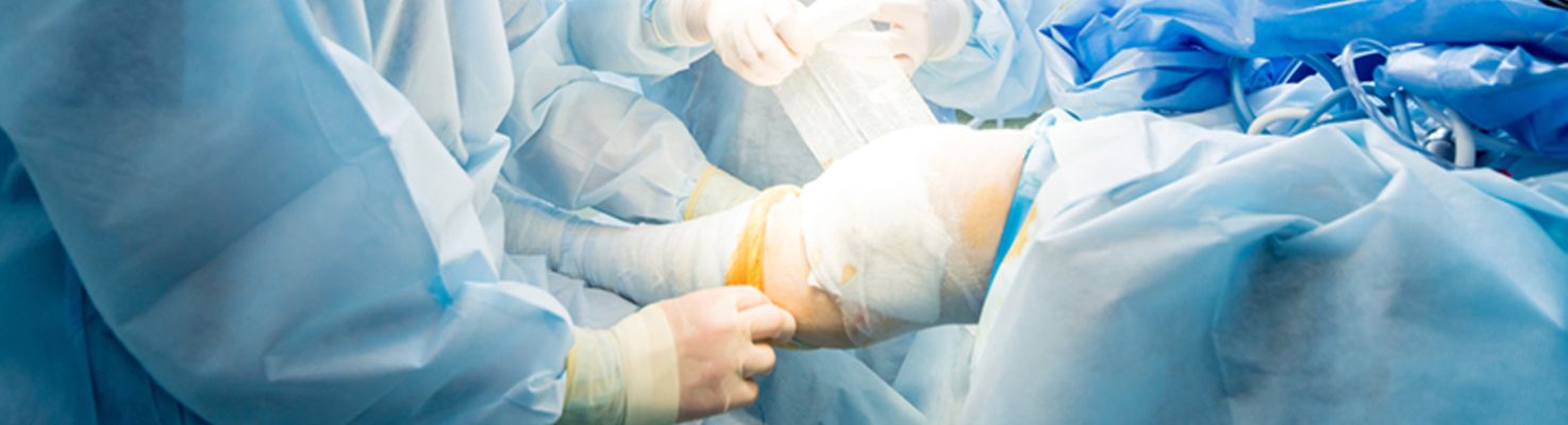 Treating Severe Fractures: ORIF (Open Reduction Internal Fixation) Surgery  